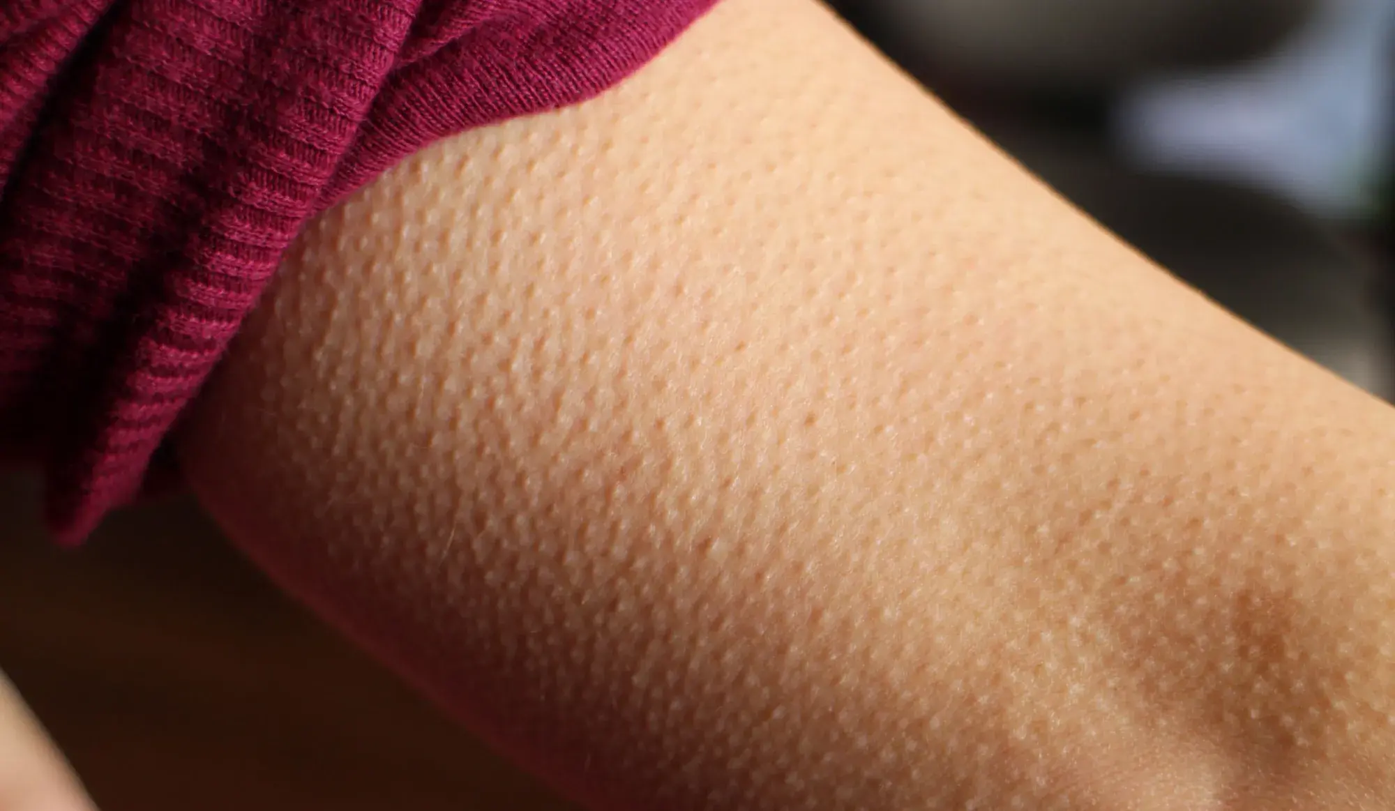O Fascínio dos Arrepios ao Ouvir Música